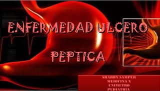 ENFERMEDAD ULCEROENFERMEDAD ULCERO
PEPTICAPEPTICA
SHARON SAMPER
MEDICINA X
UNIMETRO
PEDIATRIA
 