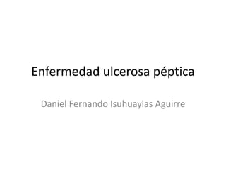 Enfermedad ulcerosa péptica
Daniel Fernando Isuhuaylas Aguirre
 