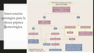 Intervención
quirúrgica para la
úlcera péptica
hemorrágica
 