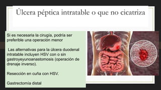 Úlcera péptica intratable o que no cicatriza
Si es necesaria la cirugía, podría ser
preferible una operación menor
Las alternativas para la úlcera duodenal
intratable incluyen HSV con o sin
gastroyeyunoanastomosis (operación de
drenaje inverso).
Resección en cuña con HSV.
Gastrectomía distal
 