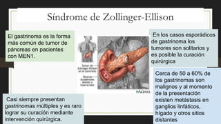 Síndrome de Zollinger-Ellison
El gastrinoma es la forma
más común de tumor de
páncreas en pacientes
con MEN1.
Casi siempre presentan
gastrinomas múltiples y es raro
lograr su curación mediante
intervención quirúrgica.
En los casos esporádicos
de gastrinoma los
tumores son solitarios y
es posible la curación
quirúrgica
Cerca de 50 a 60% de
los gastrinomas son
malignos y al momento
de la presentación
existen metástasis en
ganglios linfáticos,
hígado y otros sitios
distantes
 