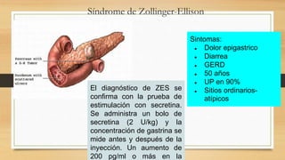 Síndrome de Zollinger-Ellison
Sintomas:
● Dolor epigastrico
● Diarrea
● GERD
● 50 años
● UP en 90%
● Sitios ordinarios-
atípicos
El diagnóstico de ZES se
confirma con la prueba de
estimulación con secretina.
Se administra un bolo de
secretina (2 U/kg) y la
concentración de gastrina se
mide antes y después de la
inyección. Un aumento de
200 pg/ml o más en la
 