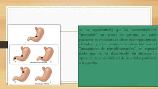 se ha argumentado que las concentraciones
“normales” en ayuno de gastrina en estos
pacientes se encuentra en cifras inapropiadamente
elevadas, y que existe una alteración en el
“mecanismo de retroalimentación”, en especial
dado que se ha demostrado un incremento
aparente en la sensibilidad de las células parietales
a la gastrina.
Secreción de ácido y úlcera péptica
 