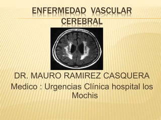 ENFERMEDAD VASCULAR 
CEREBRAL 
DR. MAURO RAMIREZ CASQUERA 
Medico : Urgencias Clínica hospital los 
Mochis 
 
