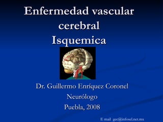 Enfermedad vascular cerebral Isquemica Dr. Guillermo Enríquez Coronel Neurólogo Puebla, 2008 E mail  [email_address] 