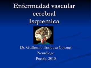 Enfermedad vascular cerebral Isquemica Dr. Guillermo Enríquez Coronel Neurólogo Puebla, 2010 