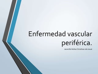 Enfermedad vascular
periférica.
Jaramillo NúñezChristhian Job Josué
 