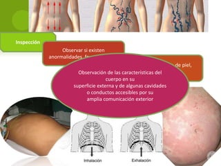 Inspección
Observar si existen
anormalidades, forma, tamaño
Textura, coloración de piel,
circulación
Observación de las características del venosa.
cuerpo en su
Movimientos : externa y de algunas cavidades
superficie
•Respiración: predominio diafragmático.
o conductos accesibles por su
•Movimientos peristálticos.
amplia comunicación exterior

 