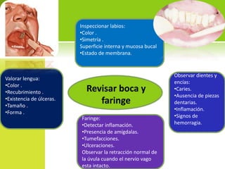 Inspeccionar labios:
•Color .
•Simetría .
Superficie interna y mucosa bucal
•Estado de membrana.

Valorar lengua:
•Color .
•Recubrimiento .
•Existencia de úlceras.
•Tamaño .
•Forma .

Revisar boca y
faringe
Faringe:
•Detectar inflamación.
•Presencia de amígdalas.
•Tumefacciones.
•Ulceraciones.
Observar la retracción normal de
la úvula cuando el nervio vago
esta intacto.

Observar dientes y
encías:
•Caries.
•Ausencia de piezas
dentarias.
•Inflamación.
•Signos de
hemorragia.

 