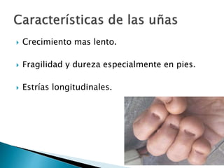  Crecimiento mas lento.
 Fragilidad y dureza especialmente en pies.
 Estrías longitudinales.
 
