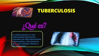 TUBERCULOSIS
¿Qué es?
La tuberculosis es una
enfermedad infecciosa
causada por Mycobacterium
tuberculosis, una bacteria
que casi siempre afecta a
los pulmones.
 
