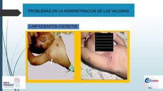 PROBLEMAS EN LA ADMINISTRACION DE LAS VACUNAS
 