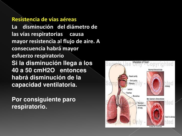 Enfermeria obstruccion via aerea