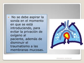 

No se debe aspirar la
sonda en el momento
en que se está
introduciendo, para
evitar la privación de
oxígeno al
paciente, además de
disminuir el
traumatismo a las
membranas mucosas.
ENFERMERIA URGENCIAS

 