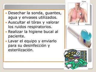 Desechar la sonda, guantes,
agua y envases utilizados.
 Auscultar el tórax y valorar
los ruidos respiratorios.
 Realizar la higiene bucal al
paciente.
 Lavar el equipo y enviarlo
para su desinfección y
esterilización.


ENFERMERIA URGENCIAS

 