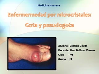 Alumna : Jessica Dávila
Docente: Dra. Balbina Vereau
Ciclo : VI
Grupo : 3
Medicina Humana
 