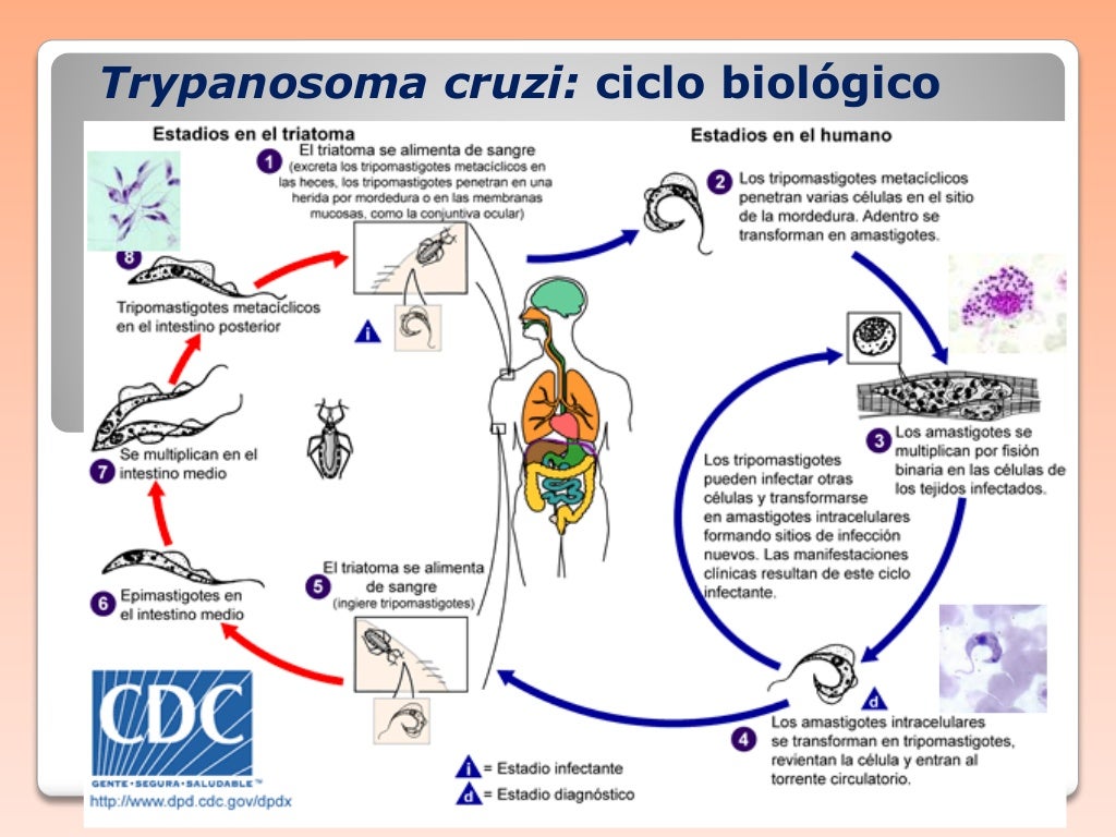 Enfermedad de chagas