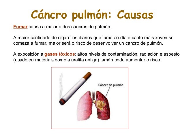 Suplemento dietético de aumento em umas respostas de busto