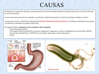 CAUSAS
Normalmente, a mucosa do estómago e primeiras porcións do intestino delgado (duodeno) está protexida contra os ácidos do estómago
por un moco protector.
Se este revestimento protector non se produce se producirá a inflamación (gastrite) ou úlcera do estómago ao dañarse a mucosa.
A causa máis común é a infección do estómago pola bacteria Helicobacter pylori (H. pylori), sen embargo, moitas persoas que posúen
esta bacteria no estómago non padecen unha úlcera.
Os seguintes factores aumentan o risco de padecer úlceras pépticas:
•Tomar demasiado alcohol.
•Uso regular de ácido acetilsalicílico (aspirina), ibuprofeno o naproxeno ou outros antinflamatorios non esteroides (AINES).
Tomar ácido acetilsalicílico ou AINES de vez en cando é seguro para a maioría das persoas.
•Fumar.
Helicobacter pylori
 
