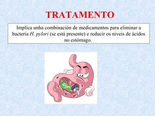 TRATAMENTO
Implica unha combinación de medicamentos para eliminar a
bacteria H. pylori (se está presente) e reducir os niveis de ácidos
no estómago.
 