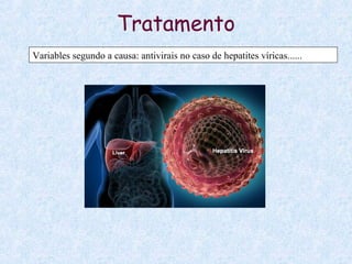 Tratamento
Variables segundo a causa: antivirais no caso de hepatites víricas......
 