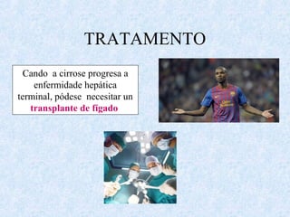TRATAMENTO
Cando a cirrose progresa a
enfermidade hepática
terminal, pódese necesitar un
transplante de fígado
 