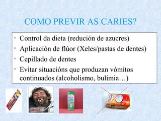 COMO PREVIR AS CARIES?
• Control da dieta (redución de azucres)
• Aplicación de flúor (Xeles/pastas de dentes)
• Cepillado de dentes
• Evitar situacións que produzan vómitos
continuados (alcoholismo, bulimia…)
 