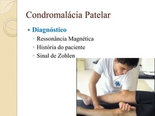 Condromalácia Patelar
   Diagnóstico
    ◦ Ressonância Magnética
    ◦ História do paciente
    ◦ Sinal de Zohlen
 