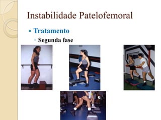 Instabilidade Patelofemoral
   Tratamento
    ◦ Segunda fase
 