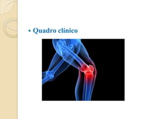   Quadro clínico
 