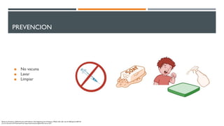 PREVENCION
◼ No vacuna
◼ Lavar
◼ Limpiar
Mende, M., & Sockel, K. (2018). Parvovirus B19 Infection. New England Journal of Medicine, 379(24), 2361-2361. doi:10.1056/nejmicm1807156
O. (n.d.). Parvovirus B19. Retrieved from https://www.osmosis.org/learn/Parvovirus_B19
 