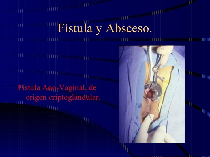 Como Sentarse Con Una Fístula Enfermedad hemorroidal. Cirugía colo-rectal