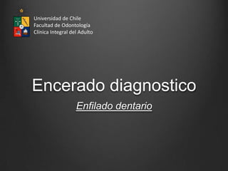 Universidad de Chile
Facultad de Odontología
Clínica Integral del Adulto




Encerado diagnostico
                   Enfilado dentario
 