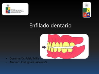 Enfilado dentario
• Docente: Dr. Pablo Milla
• Alumno: José Ignacio Arenas V.
 