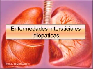 Enfermedades intersticiales
idiopáticas
RAÚL E. GÓMEZ PAREDES
 