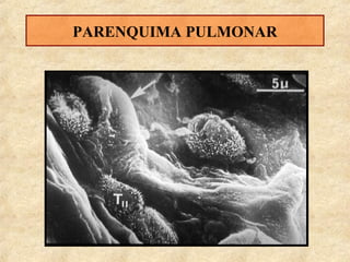 PARENQUIMA PULMONAR

 