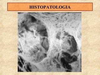 HISTOPATOLOGIA

 