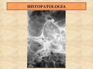 HISTOPATOLOGIA

 
