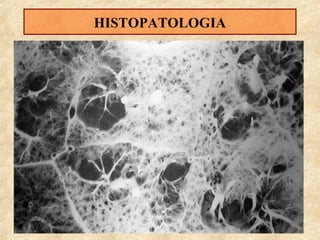 HISTOPATOLOGIA

 