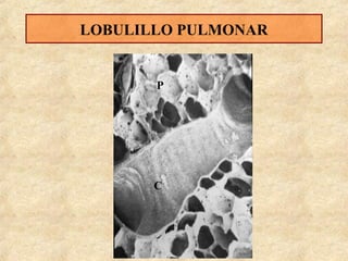 LOBULILLO PULMONAR

P

C

 