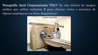 Tomografía Axial Computarizada (TAC): Es una técnica de imagen
médica que utiliza radiación X para obtener cortes o secciones de
objetos anatómicos con fines diagnósticos.
 