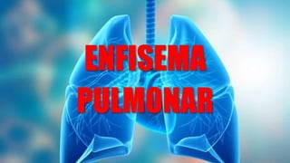 ENFISEMA
PULMONAR
 