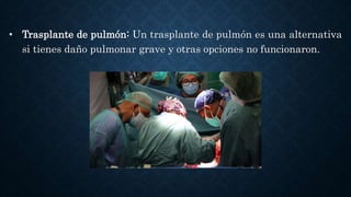 • Trasplante de pulmón: Un trasplante de pulmón es una alternativa
si tienes daño pulmonar grave y otras opciones no funcionaron.
 
