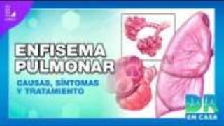 ENFISEMA PULMONAR.pptx