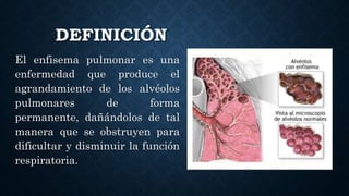 DEFINICIÓN
El enfisema pulmonar es una
enfermedad que produce el
agrandamiento de los alvéolos
pulmonares de forma
permanente, dañándolos de tal
manera que se obstruyen para
dificultar y disminuir la función
respiratoria.
 