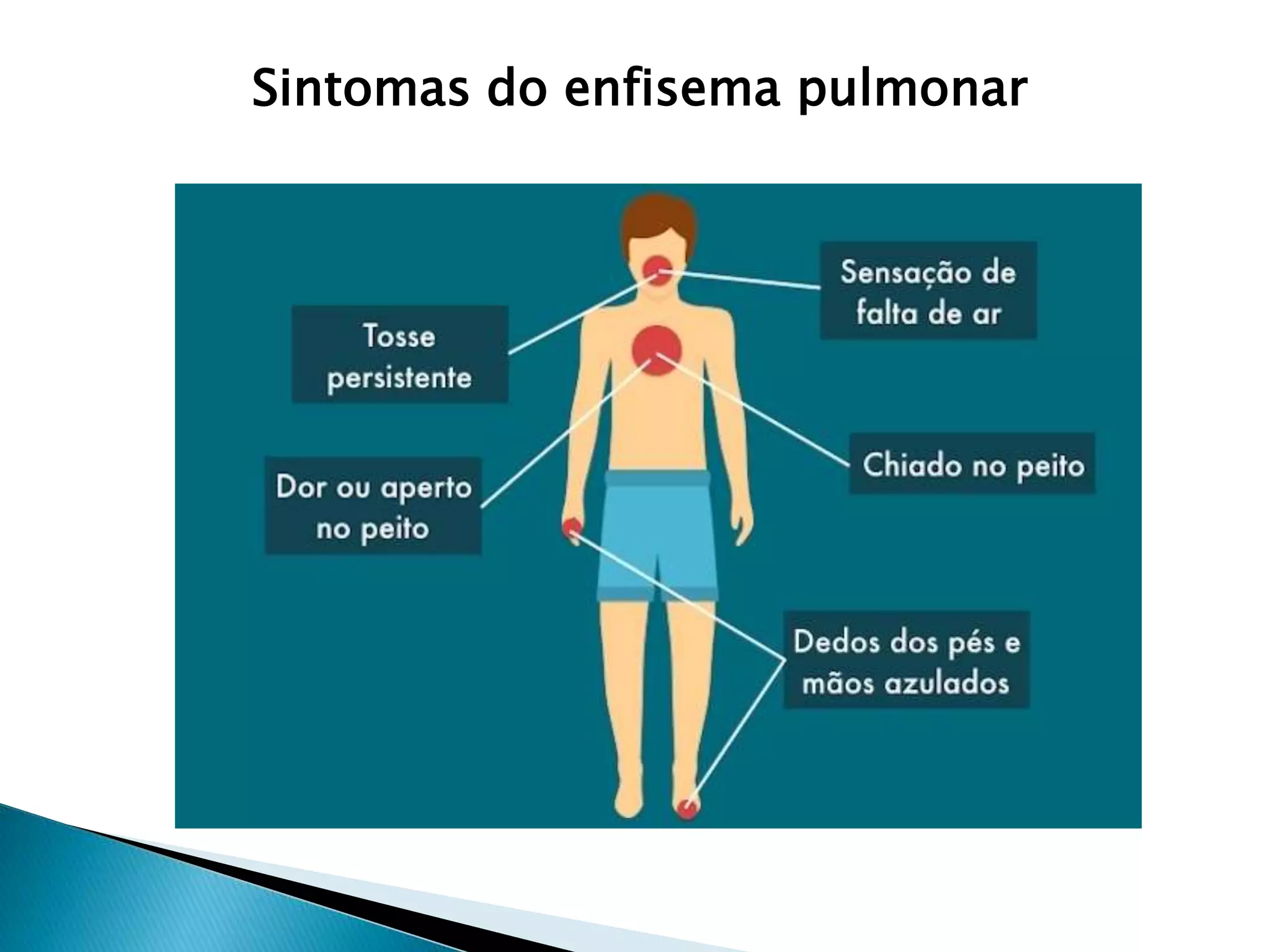 Enfisema Pulmonar.pptx