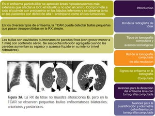 En el enfisema panlobulillar se aprecian áreas hipoatenunantes más
extensas que afectan a todo el lobulillo y no sólo al centro. Compromete a                 Introducción
todo el pulmón con predominio en los lóbulos inferiores y se observa tanto
en los pacientes con déficit de alfa 1 antitripsina como en los fumadores.

                                                                                Rol de la radiografía de
En los diversos tipos de enfisema, la TCAR puede detectar bullas pequeñas                          tórax
que pasan desapercibidas en la RX simple.

                                                                                   Tipos de tomografía
Las bullas son cavidades pulmonares de paredes finas (con grosor menor a                  computada y
1 mm) con contenido aéreo. Se sospecha infección agregada cuando las
                                                                                  avances tecnológicos
paredes aumentan su espesor y aparece líquido en su interior (nivel
hidroaéreo).
                                                                                   Rol de la tomografía
                                                                                            computada
                                                                                     de alta resolución


                                                                              Signos de enfisema en la
                                                                                            tomografía
                                                                                           Computada


                                                                             Avances para la detección
                                                                                 del enfisema leve con
                                                                                tomografía computada

                                                                                        Avances para la
                                                                             cuantificación y volumetría
                                                                                       del enfisema con
                                                                                tomografía computada
 