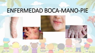 ENFERMEDAD BOCA-MANO-PIE
Dra.Karla Hernandez Mathews
 
