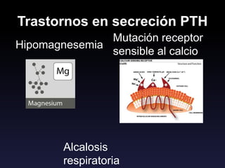 Trastornos en secreción PTH
Hipomagnesemia
Mutación receptor
sensible al calcio
Alcalosis
respiratoria
 