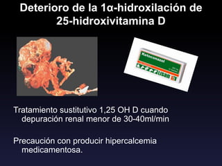 Deterioro de la 1α-hidroxilación de
25-hidroxivitamina D
Tratamiento sustitutivo 1,25 OH D cuando
depuración renal menor de 30-40ml/min
Precaución con producir hipercalcemia
medicamentosa.
 